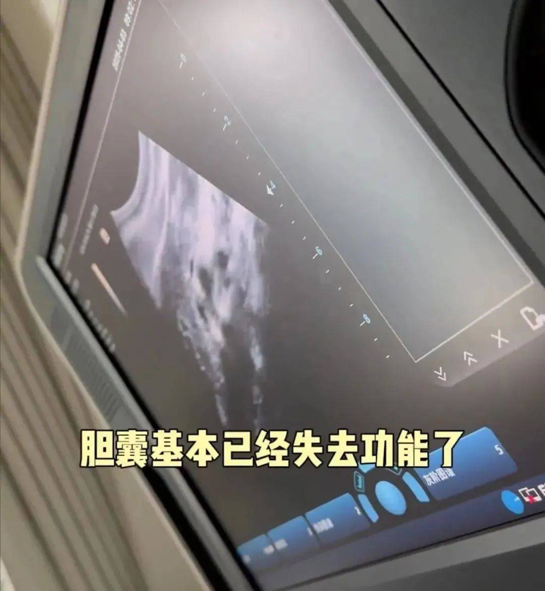 澳大利亚(女) v 荷兰(女)
_36岁知名女演员确诊澳大利亚(女) v 荷兰(女)
！“已基本失去功能”