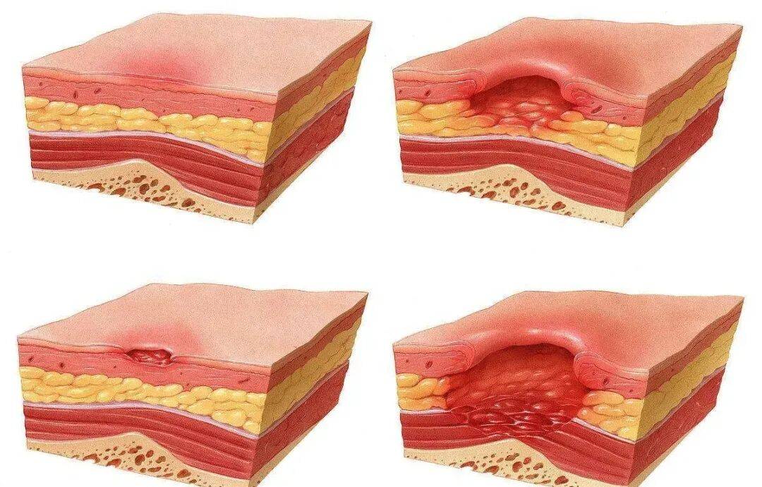 金州女武神vs纽约自由人_一觉醒来金州女武神vs纽约自由人，21岁女生的屁股惨不忍睹！严重或危及生命