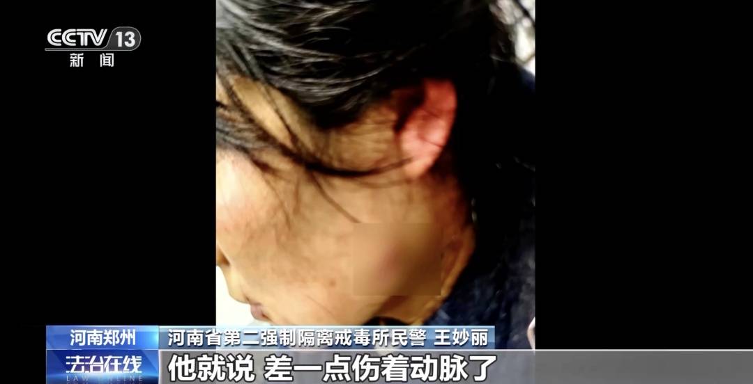 皇冠投注_女警徒手夺刀皇冠投注，脸上缝30多针：后怕但不后悔